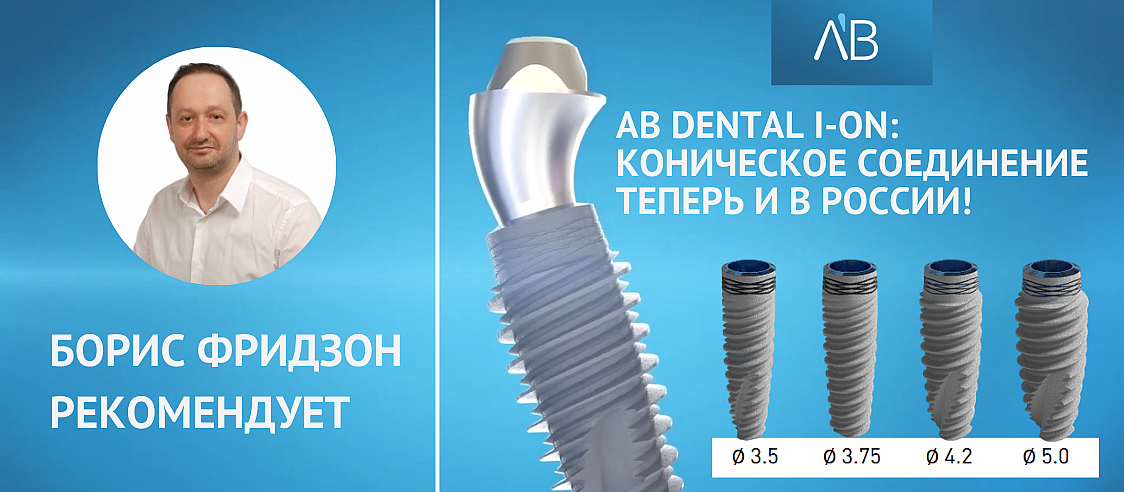 AB_Dental-I-ON-banner492-2